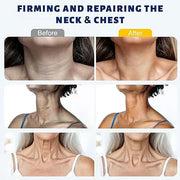 Roller Massage Neck Cream 🧴 Collagen & Hyaluronic Acid | Firms Neck, Reduces Wrinkles & Double Chin✨ thumbnail 5