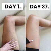 JEREMYTIS™ Cellulite Relief Kit thumbnail 5