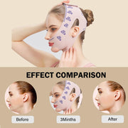 V-Line Lifting Face Band thumbnail 5