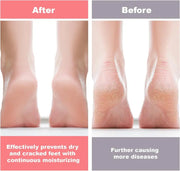 Silicone Protective Moisturizing Foot Socks for Foot Care thumbnail 6
