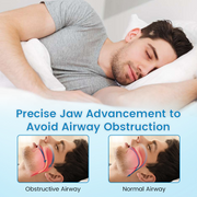 JEREMYTIS™ Anti-Snoring & Anti-Grinding Teeth Protector thumbnail 6