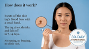 Skin Tag Removal Kit thumbnail 3