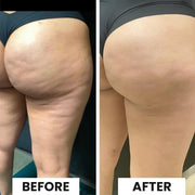 JEREMYTIS™ Cellulite Relief Kit thumbnail 6