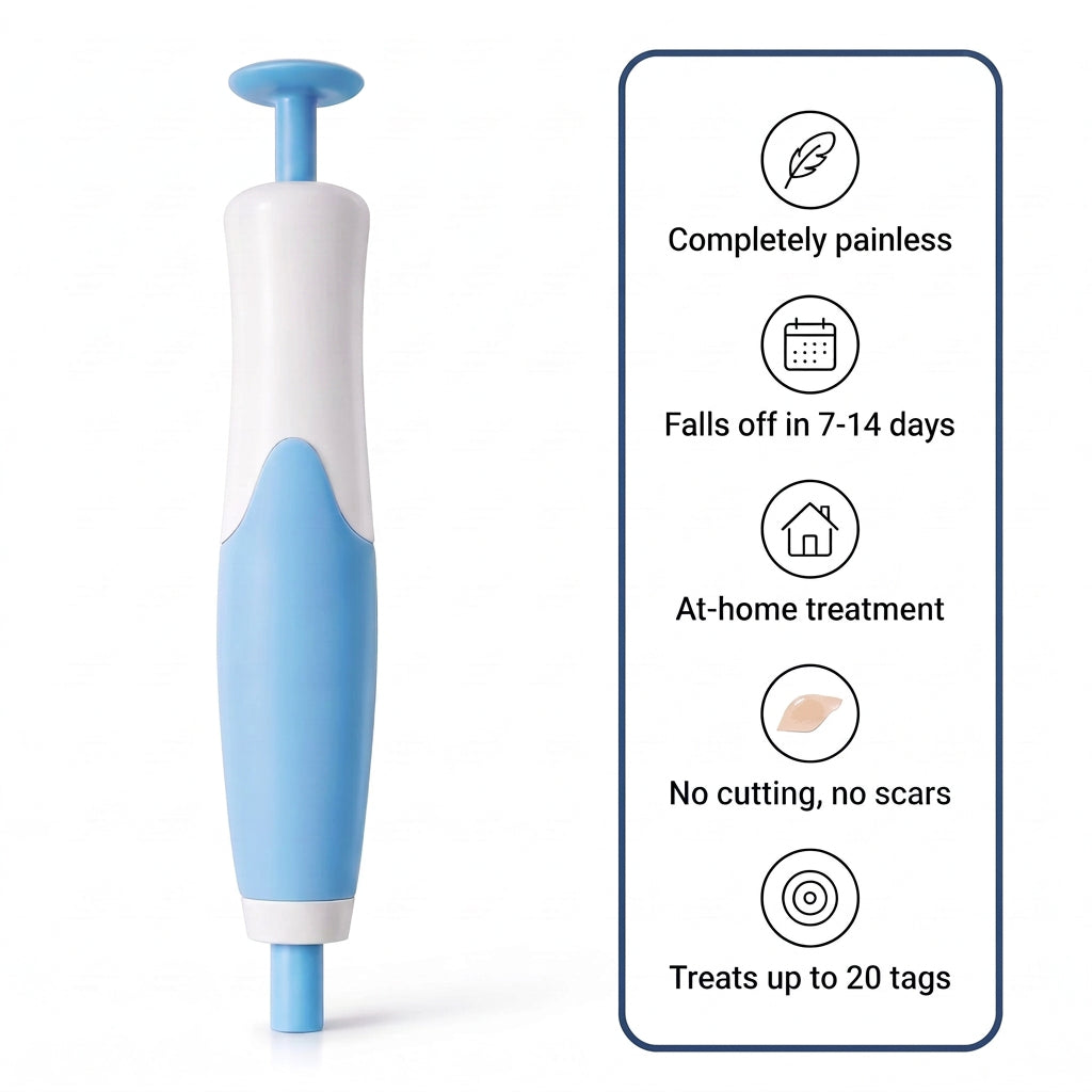 Skin Tag Removal Kit