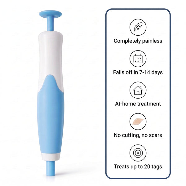 Skin Tag Removal Kit