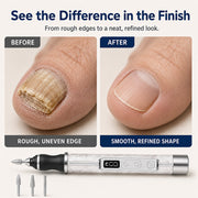 Electric Nail File & Callus Remover thumbnail 3